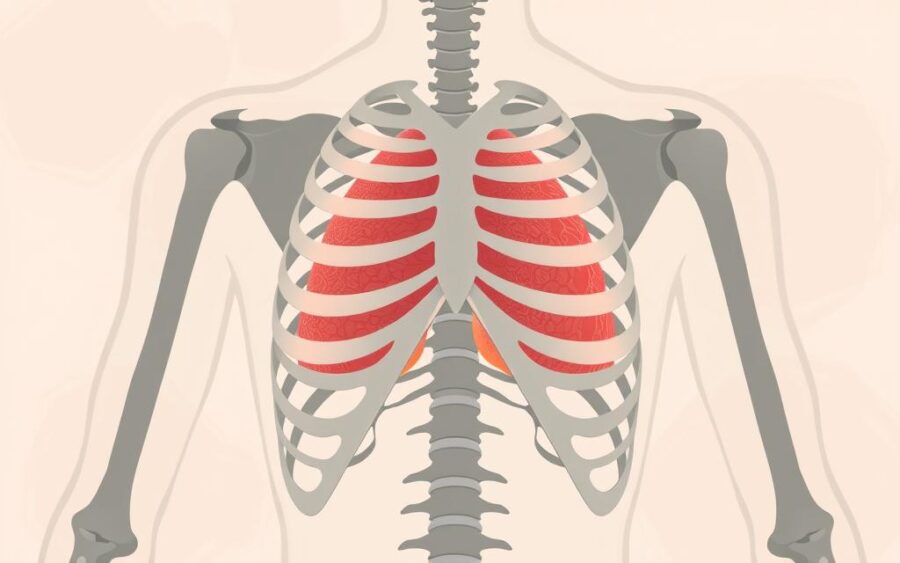 zespół sztywnej klatki piersiowej zespół sztywnej klatki piersiowej